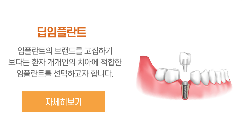 민들레치과 딥임플란트 자세히 보기